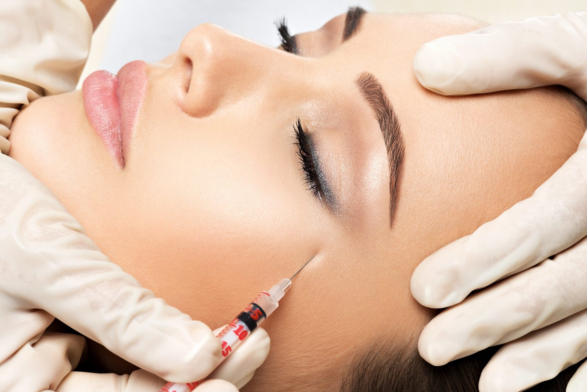 Woman getting cosmetic injection of botox near eyes