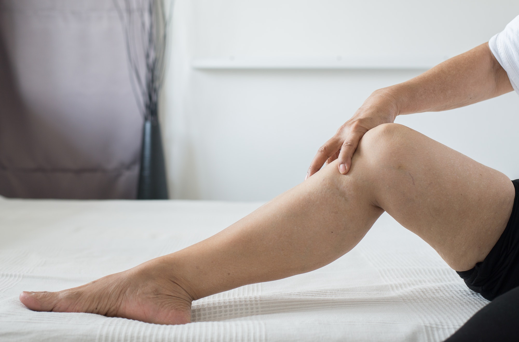 Scars on leg elderly woman with problematic problem skin close up